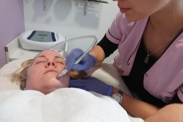 Microdermoabrasion- Punta de diamante (1)