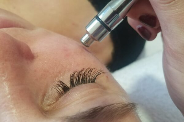 Microdermoabrasion- Punta de diamante (2)